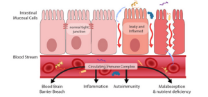 The Truth About Stomach Acid - Jill Mac Nutrition