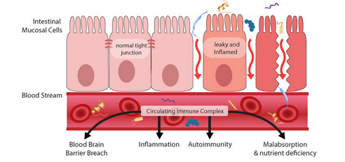 intestino-permeable-21